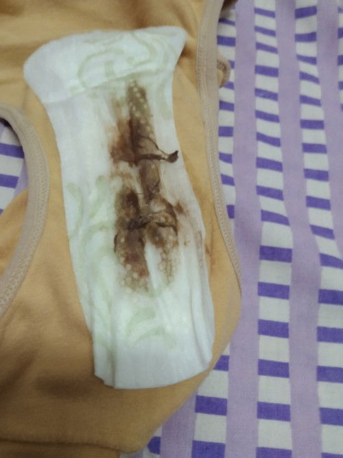 Hamil 7 minggu, Ibu2 ada tak pengalaman mcm saya?