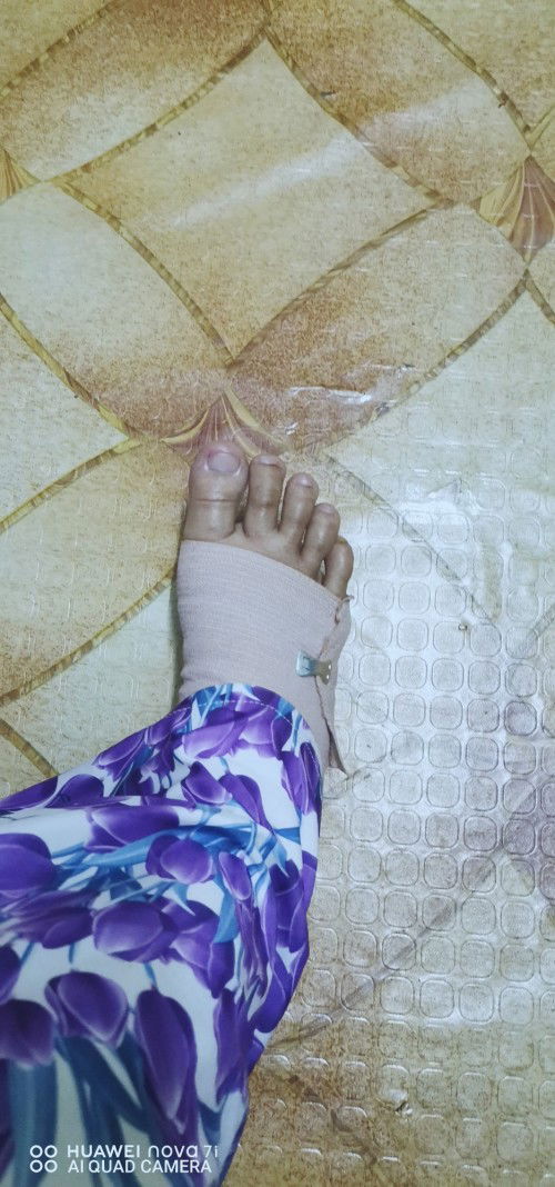32 weeks Kaki bengkak tiba2.