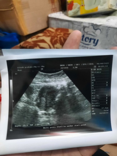 Hpht 22juni, tespek +, cek usg ada kantong hamil, tp kata dokter ada pnebalan dinding rahim abnormal
