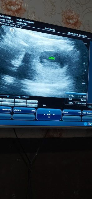 USG hari ini 9W0d 🥰