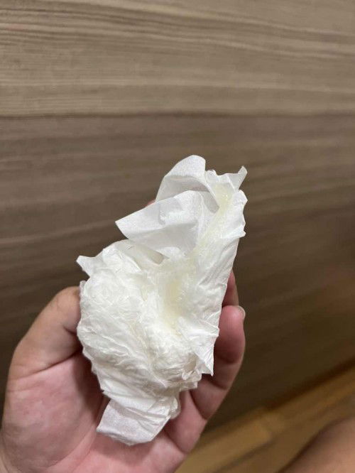 ท้องได้37+6ค่ะ มีมูกแบบนี้ออกเยอะมาก