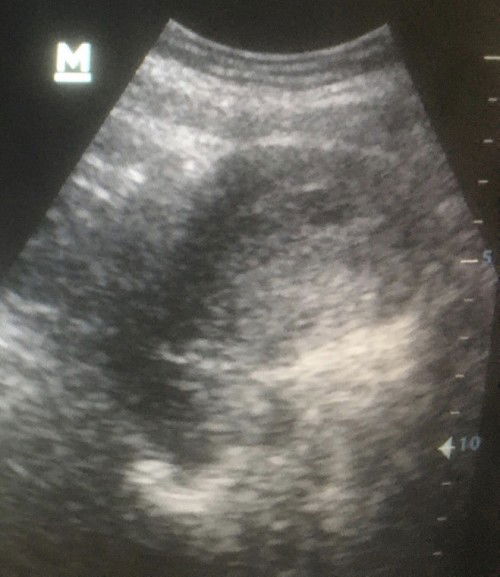 Hamil 9w usg