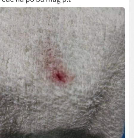Implantation po ba iyan...nung aug.5 po iyan tapos wala na po july 7 po last period ko....