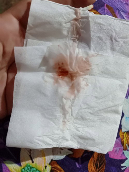 Keluar flek tapi tak kunjung kontraksi. #seriusnanya #firstmom #pleasehelp #firstbaby