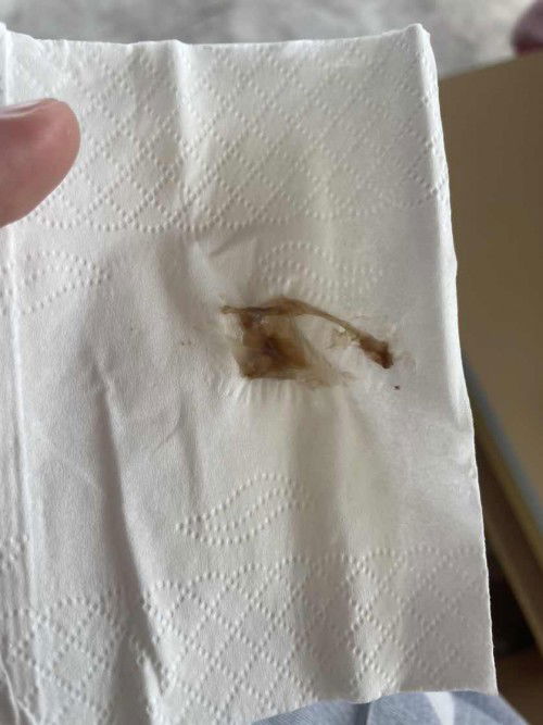 มูกแบบนี้คือใกล้คลอดยังคะ😅