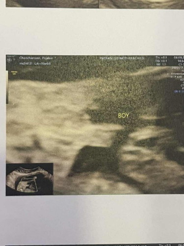 20week รู้เพศกันหรือยังคะ
