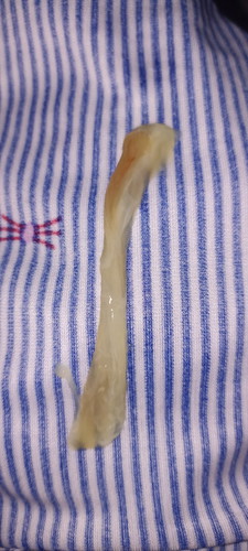 Mucus plug na po ba ito?