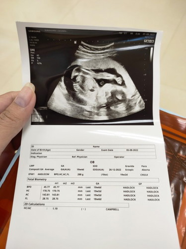 เบบี๋ 20 week กำลังดิ้นเก่งเลย🥰🥰
บ้านอื่น เป็นไงบ้างดิ้นเก่งมั้ยคะ ส่งอัลตร้าซาวด์มาอวดกันค่ะ