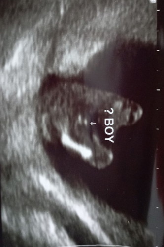 baby boy ka ni