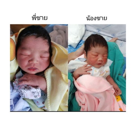 เด็ก2เดือน ใน1 ปี