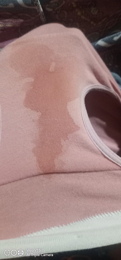 Watery discharge