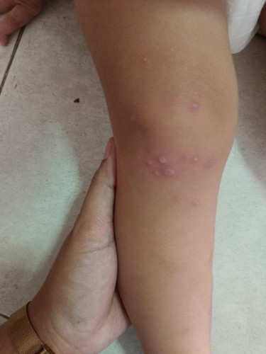 สอบถามแม่ๆหรือผู้รู้