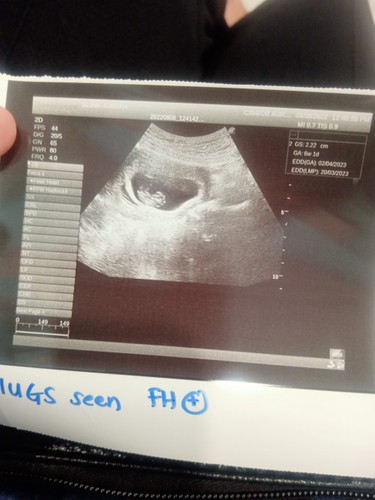 Scan 2D early
