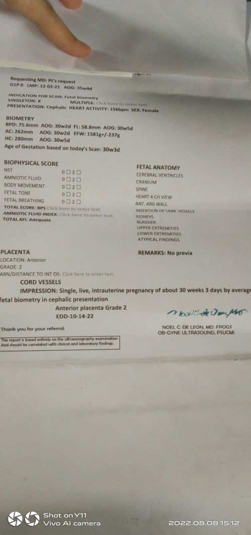 Ok lang Kaya si baby o normal ba sya?