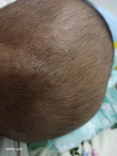 Kepala bayi 3bulan