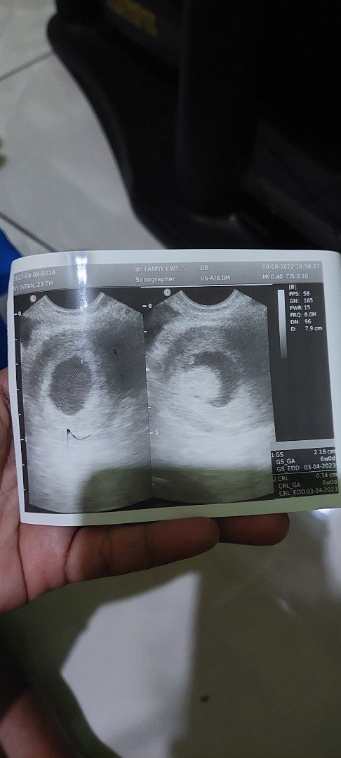 Kira kira Ini sudah terlihat apa belum bun??