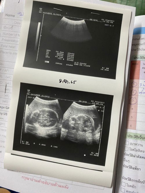 สอบถามหน่อยค่ะ