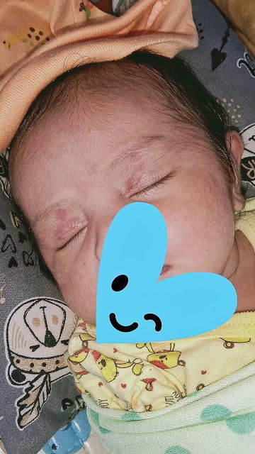 Tanda merah di sekitar mata