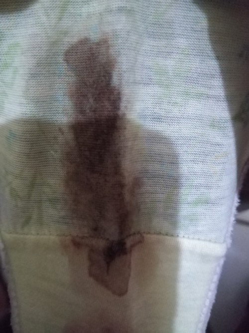 Hello mga momies anu po ibig sabihin neto brown stain sa undies ko? Wala nman po ako pain na