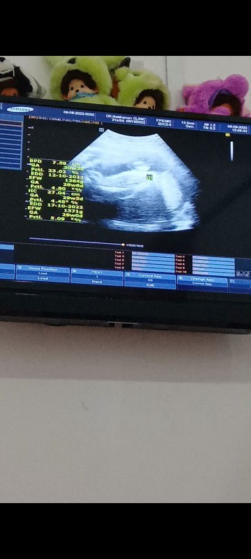 ญ หรือ ช