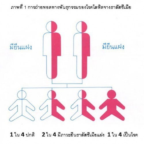  เจาะน้ำคร่ำพาหะธาลัสซีเมีย