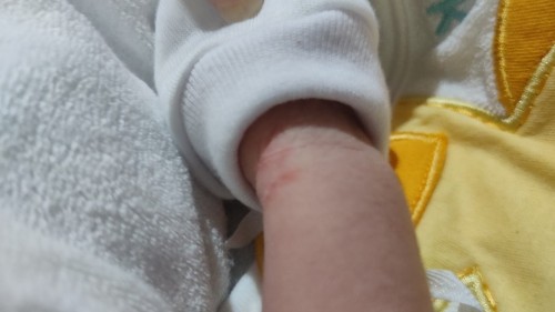 anong pwede pong igamot?