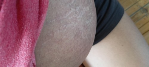 hiccups or heartbeat