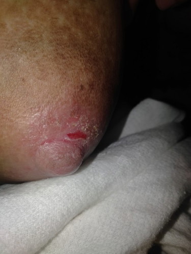 Breastfeeding problem