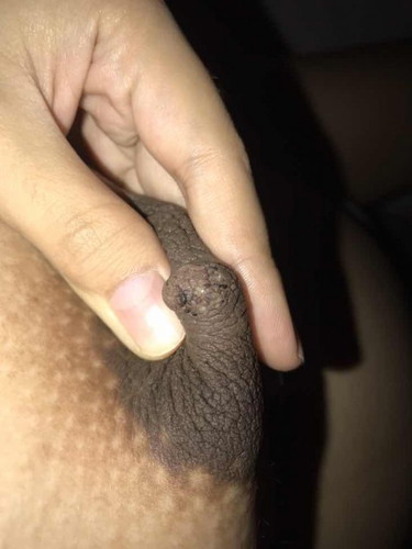 BLACK DOTS