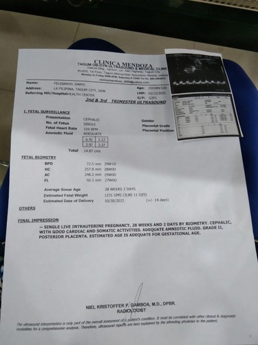 Malaki Baby sa Tiyan