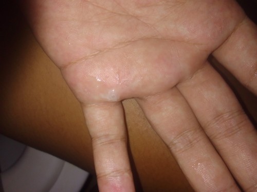 มีมูก ขาวๆใสๆออกมาแบบนี้ ไปหาหมอดีไหมค่ะ 36+3w