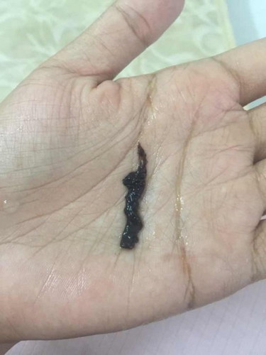 Spotting colour coklat gelap ,