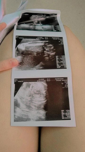 อวดภาพอัตตาซาวด์