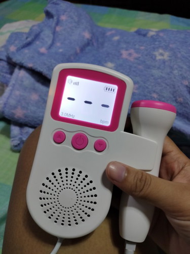 Fetal doppler