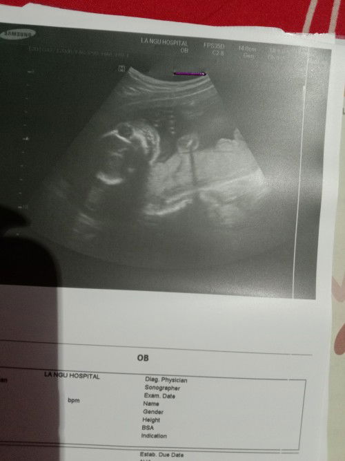 สอบถามแม่ๆ