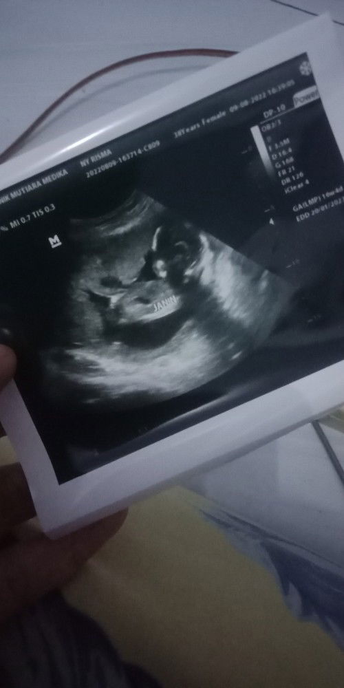 Its a boy yeayyyyyyyy