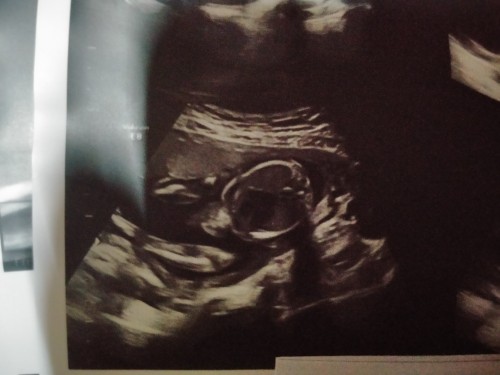 น้องเป็นผญ.รึผช.คะ
คุณหมอบอกว่าน้องเป็นผญ.