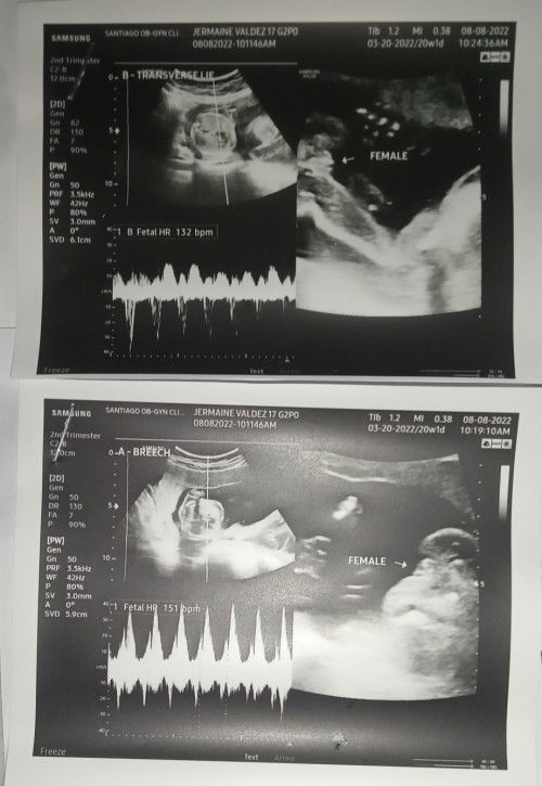 Name for baby twins girl