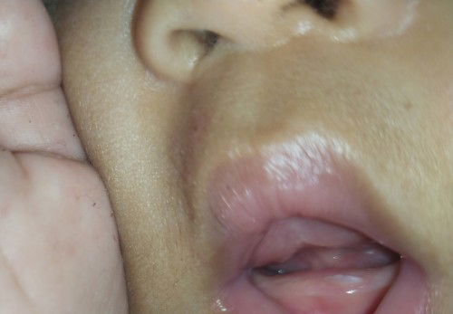 Apakah ini mau Tumgi?