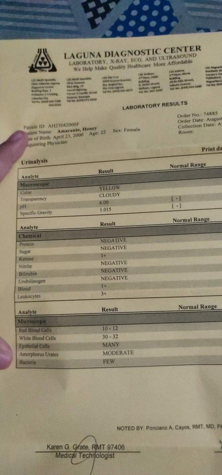 URINALYSIS