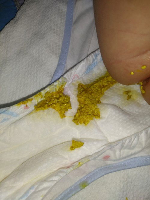 Màu sắc phân của bé