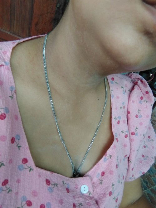 พอดีมันมีผื่นขึ้นที่หน้าอกแล้วลามขึ้นมาคอบางครั้งก็คันแต่จะแสบมากกว่าพึ่งมาเป็นตอนท้อง9เดือนคะ