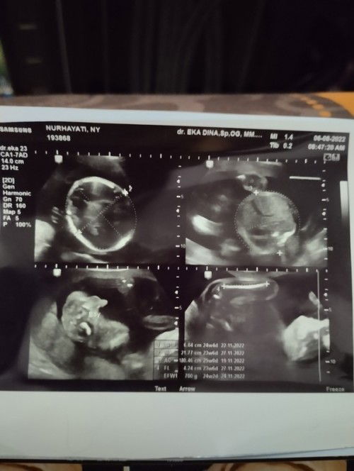 Jangan dibuli hanya sekedar bertanya