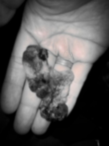 Just wanna share with you guys my Miscarriage last Monday ๐ (10w3d)