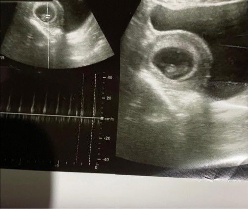 ไปหาคุณหมอครั้งแรก