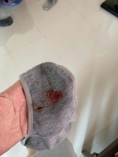 มีมูกเลือดออก