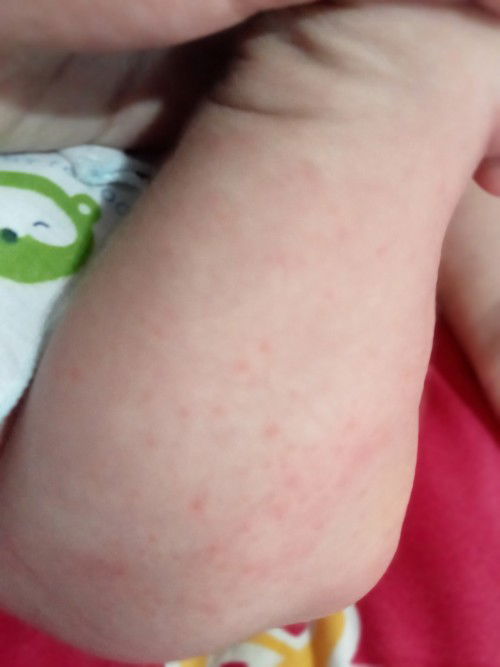 สอบถามแม่ๆ