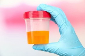 Urine warna seakan oren