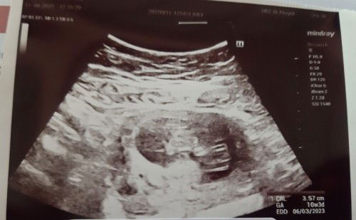 อัพเดตน้องค่ะแม่ๆ ขอดูใบอัลตร้าซาวด์ของแม่ๆได้ไหมคะ