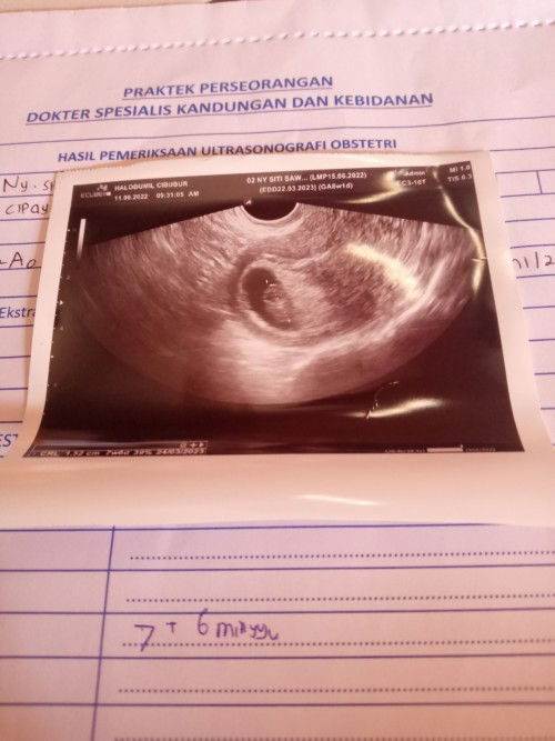 Alhamdulillah tadi pagi sudah USG dd utun